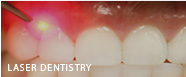 laser dentistry