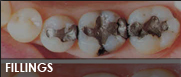 fillings fresno ca