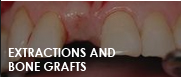 bone grafts fresno ca